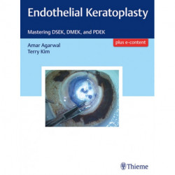 Endothelial Keratoplasty: Mastering DSEK, DMEK, and PDEK