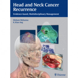 Head and Neck Cancer Recurrence: Evidence-based, Multidisciplinary Management