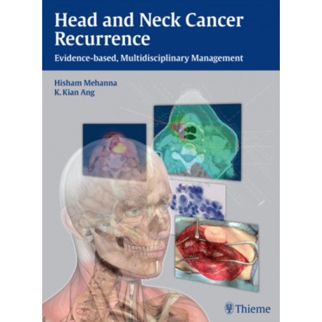 Head and Neck Cancer Recurrence: Evidence-based, Multidisciplinary Management