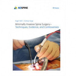 Minimally Invasive Spine Surgery - Techniques, Evidence, and Controversies: Techniques, Evidence, and Controversies
