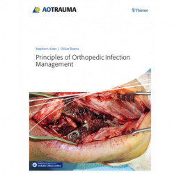 Principles of Orthopedic Infection Management