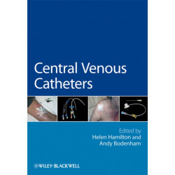 Central Venous Catheters