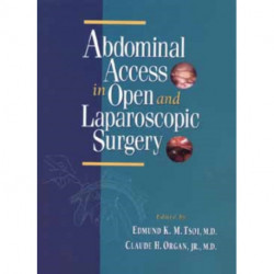 Abdominal Access in Open and Laparoscopic Surgery