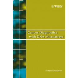 Cancer Diagnostics with DNA Microarrays