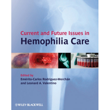 Current and Future Issues in Hemophilia Care