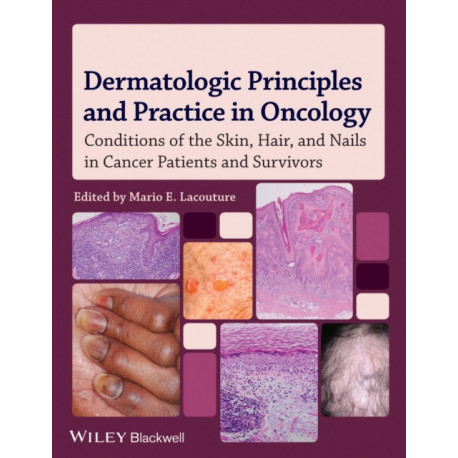 Dermatologic Principles and Practice in Oncology: Conditions of the Skin, Hair, and Nails in Cancer Patients