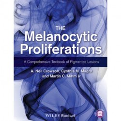 The Melanocytic Proliferations: A Comprehensive Textbook of Pigmented Lesions