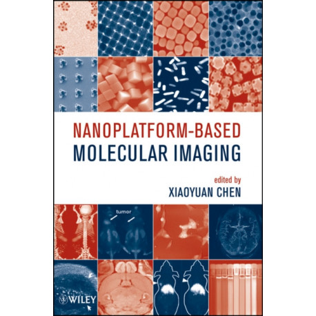 Nanoplatform-Based Molecular Imaging