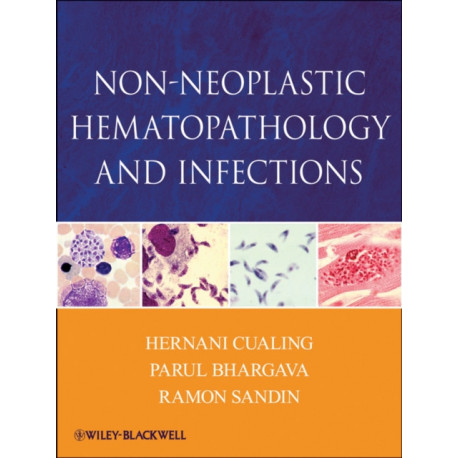 Non-Neoplastic Hematopathology and Infections