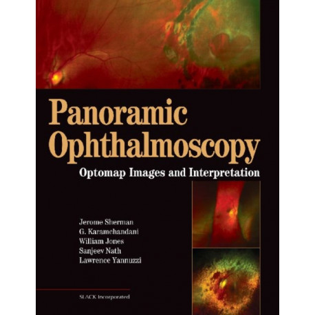 Panoramic Ophthalmoscopy: Optomap Images and Interpretation