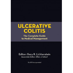 Ulcerative Colitis: The Complete Guide to Medical Management