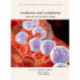 Leukemia and Lymphoma: Molecular and Therapeutic Insights