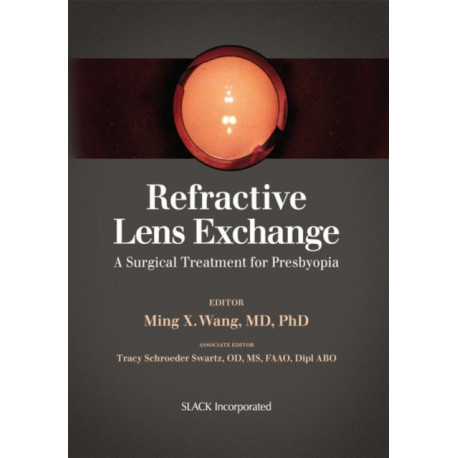 Refractive Lens Exchange: A Surgical Treatment for Presbyopia