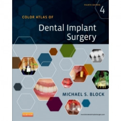 Color Atlas of Dental Implant Surgery