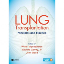 Lung Transplantation: Principles and Practice