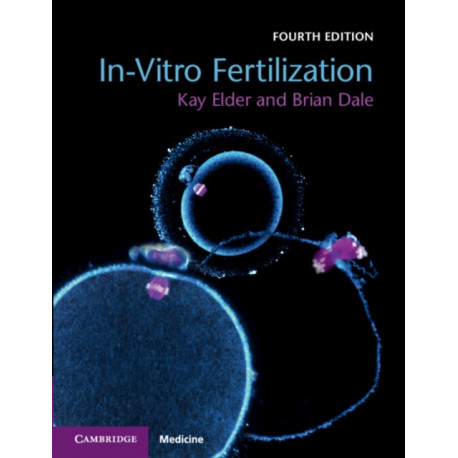 In-Vitro Fertilization