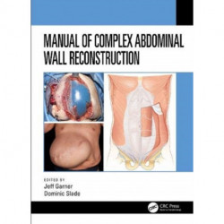 Manual of Complex Abdominal Wall Reconstruction