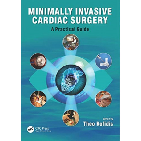 Minimally Invasive Cardiac Surgery: A Practical Guide