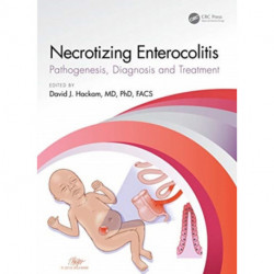 Necrotizing Enterocolitis: pathogenesis, diagnosis and treatment