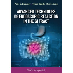 Advanced Techniques for Endoscopic Resection in the GI Tract