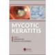 Mycotic Keratitis