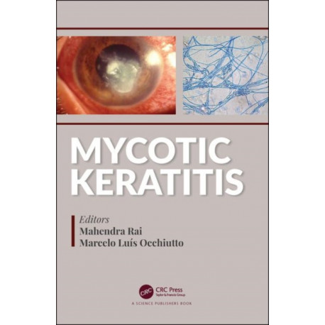 Mycotic Keratitis