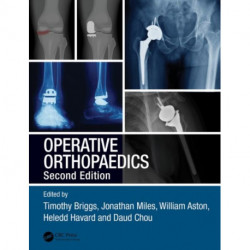 Operative Orthopaedics: The Stanmore Guide