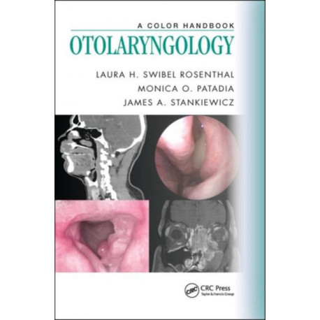 Otolaryngology: A Color Handbook