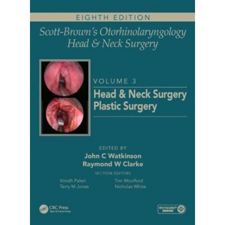 Scott-Brown's Otorhinolaryngology and Head and Neck Surgery: Volume 3: Head and Neck Surgery, Plastic Surgery