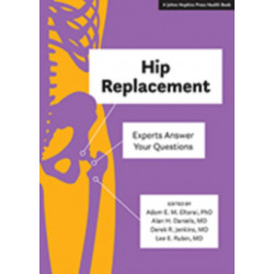 Hip Replacement: Experts Answer Your Questions