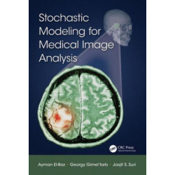 Stochastic Modeling for Medical Image Analysis