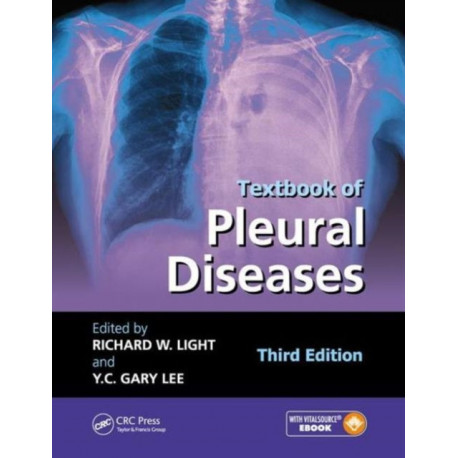Textbook of Pleural Diseases