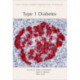 Type 1 Diabetes