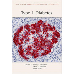 Type 1 Diabetes