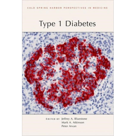 Type 1 Diabetes