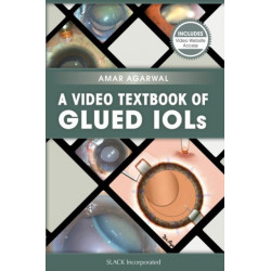 A Video Textbook of Glued IOLs