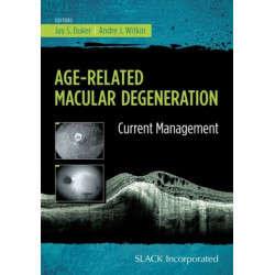 Age-Related Macular Degeneration: Current Management