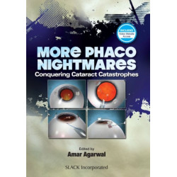 More Phaco Nightmares: Conquering Cataract Catastrophes