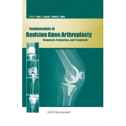 Fundamentals of Revision Knee Arthroplasty: Diagnosis, Evaluation, and Treatment