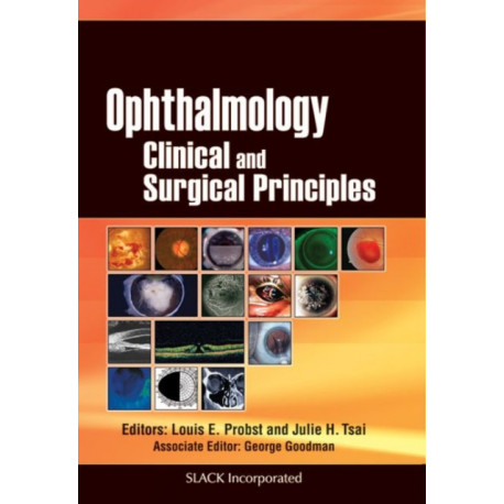 Ophthalmology: Clinical and Surgical Principles