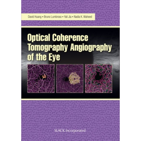 Optical Coherence Tomography Angiography of the Eye: OCT Angiography