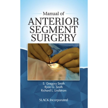 Manual of Anterior Segment Surgery