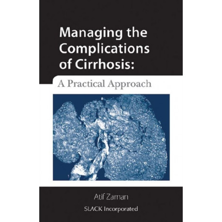 Managing the Complications of Cirrhosis: A Practical Approach