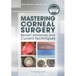 Mastering Corneal Surgery: Recent Advances and Current Techniques