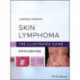 Skin Lymphoma: The Illustrated Guide
