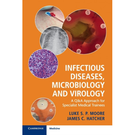 Infectious Diseases, Microbiology and Virology: A Q&A Approach for Specialist Medical Trainees
