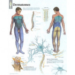 Dermatones Paper Poster