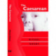 The Caesarean