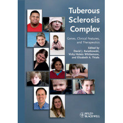 Tuberous Sclerosis Complex: Genes, Clinical Features and Therapeutics