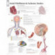 Atrial Fib & Ischemic Strokes Paper Poster